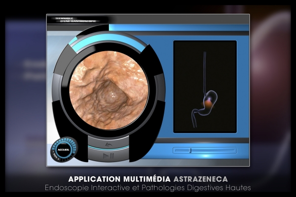 Looktrope Appli Astrazeneca-EIPDH