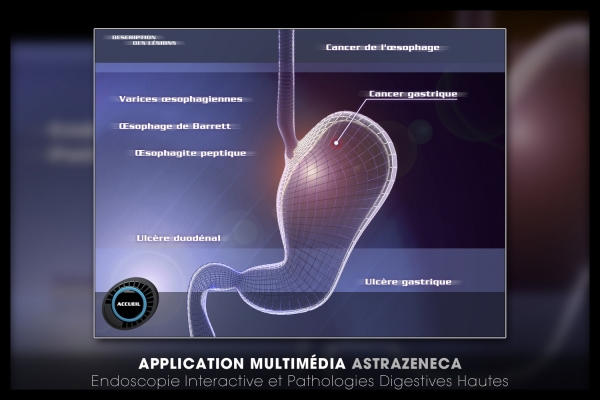 Looktrope Appli Astrazeneca-EIPDH