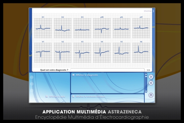 Looktrope Appli Astrazeneca-EME