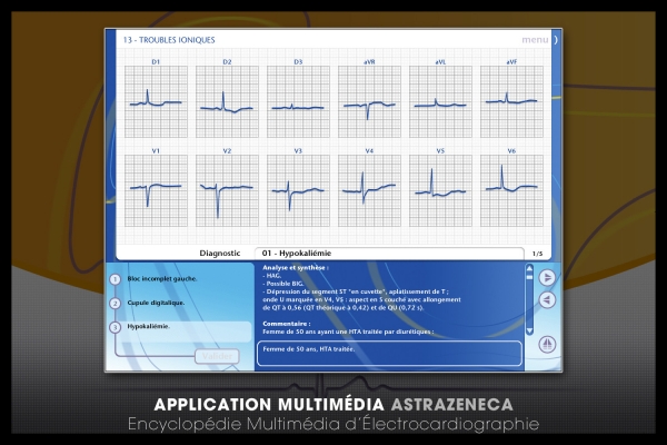 Looktrope Appli Astrazeneca-EME