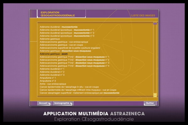 Looktrope Appli Astrazeneca-EOGD