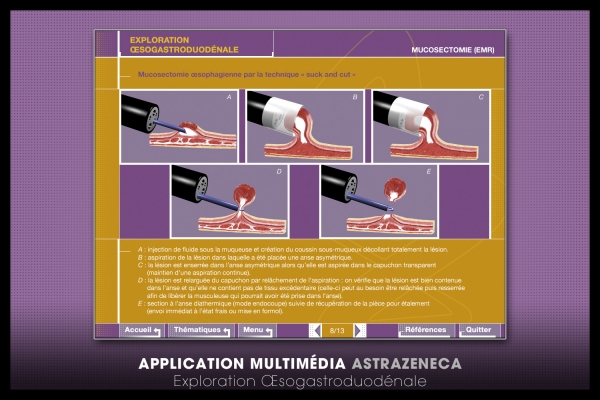 Looktrope Appli Astrazeneca-EOGD