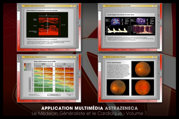 Looktrope Appli Astrazeneca-MGC Vol 1