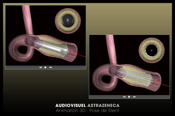 Looktrope Audiovisuel Santé Astrazeneca Animation 3D