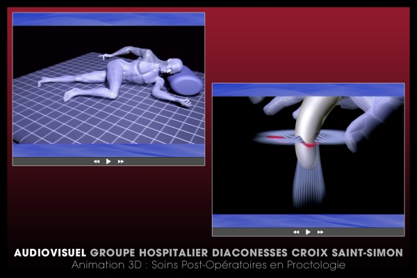Looktrope Audiovisuel Santé Diaconesses Animation 3D